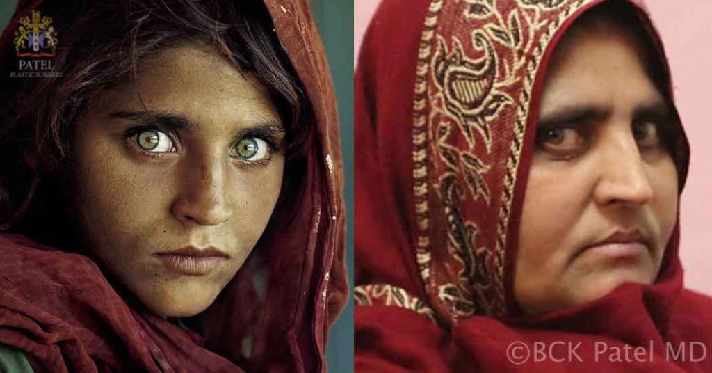 Aging of an Afgan lady