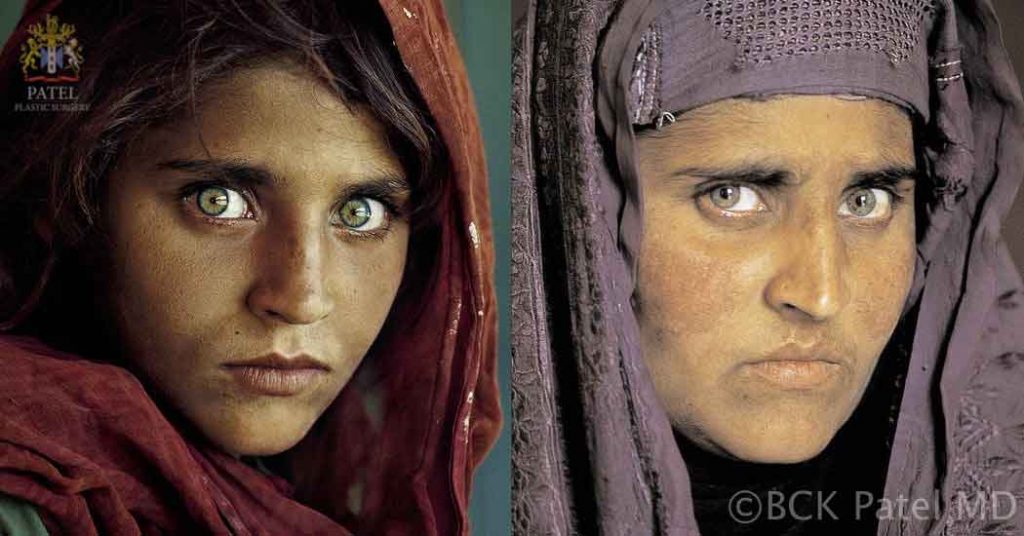 Aging of an Afgan lady